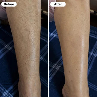 Pinara Crema Depiladora SoftTouch
