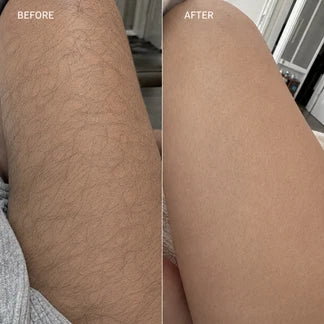 Pinara Crema Depiladora SoftTouch